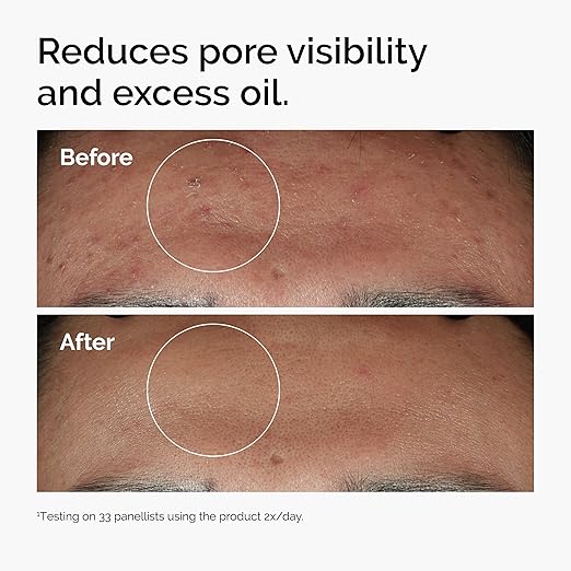 niacinamide-10-zinc-serum